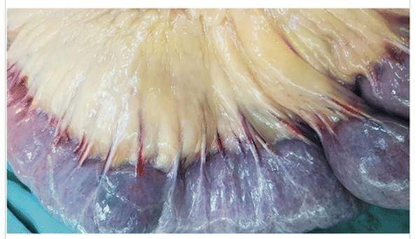 一张图+150字：顶级杂志的文章原来可以这么“水”