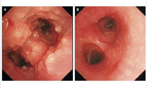 一张图+150字：顶级杂志的文章原来可以这么“水”